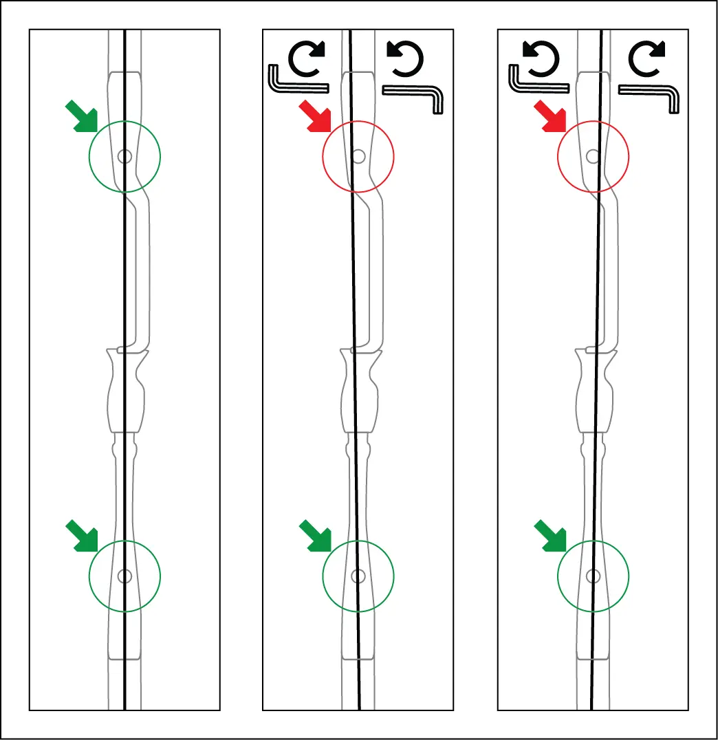 Limb Alignment